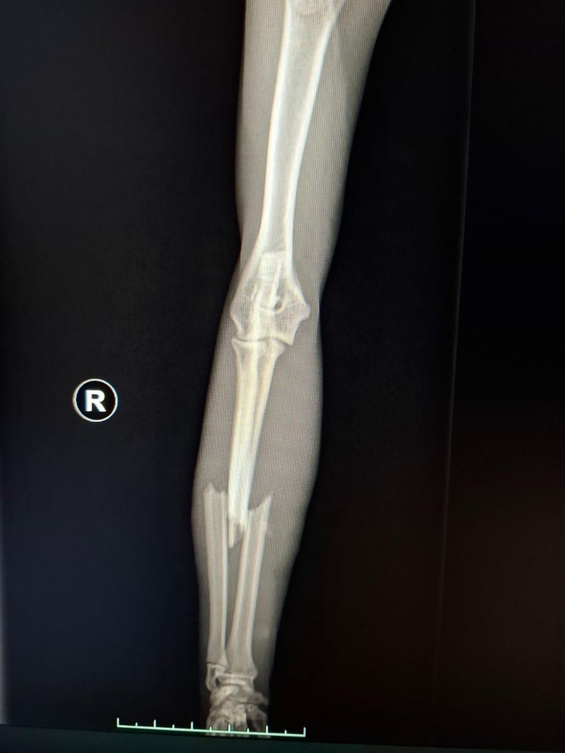 katersammytierschu az1